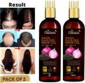 Phillauri Red Onion Hair Oil - WITH COMB APPLICATOR- Black Seed Onion Oil Hair Oil  (200 ml)
